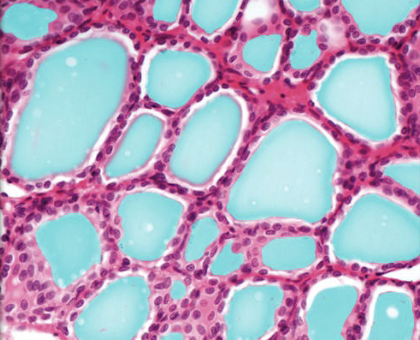 <p>colloid </p>