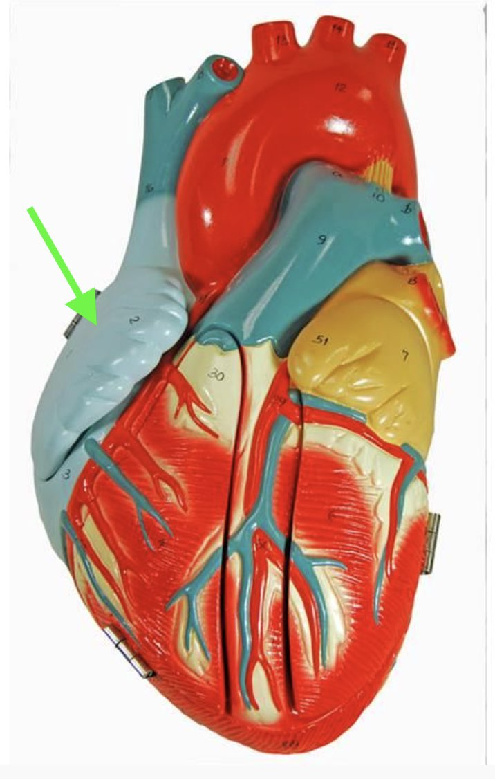 <p><strong>Identify the indicated chamber.&nbsp;</strong></p>