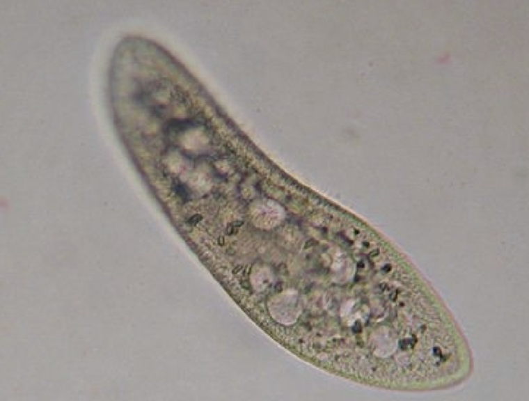 <p>What protist is this?</p>