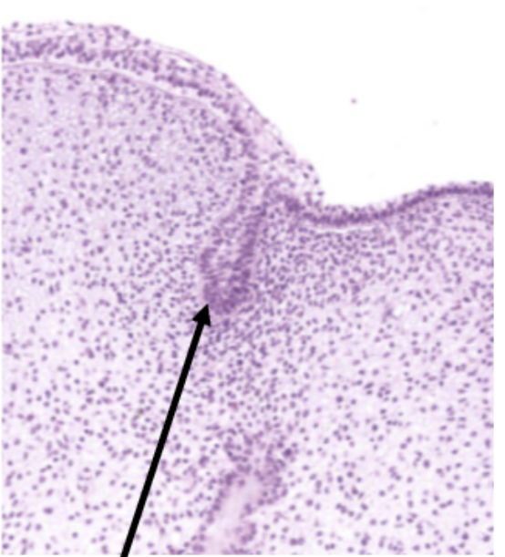 <p>ID the enamel organ stage</p>
