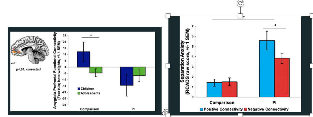 <p><strong>Previously institutionalized children</strong> (Romanian orphanages = severe deprivation, low social/cognitive input, neglect/abuse)</p><p><strong>Control group</strong> (raised by biological families)</p><ul><li><p><strong>Key brain system THIS IS NORMAL:</strong></p><ul><li><p><strong>Frontoamygdala connectivity</strong> (emotion regulation)</p></li><li><p><strong>Normative development:</strong></p><ul><li><p>Childhood → <strong>positive connectivity</strong> (less mature; co-activation)</p></li><li><p>Adolescence → <strong>negative connectivity</strong> (mature; prefrontal cortex regulates amygdala)</p></li></ul></li></ul></li><li><p><strong>Key finding (Step 1: adversity → accelerated development):</strong></p><ul><li><p>Institutionalized children show <strong>negative connectivity already in childhood </strong>→ <strong>Earlier-than-normal emergence of mature brain pattern </strong>→ Evidence of <strong>accelerated neural development</strong></p></li></ul></li><li><p><strong>Key finding (Step 2: does it improve outcomes?):</strong></p><ul><li><p>Institutionalized children overall have <strong>higher anxiety risk</strong></p></li><li><p>BUT: Those with <strong>negative (mature) connectivity → lower anxiety</strong></p><ul><li><p>Those without it → <strong>higher anxiety </strong>→ Acceleration <strong>reduces risk (doesn’t eliminate it)</strong></p></li></ul></li></ul></li></ul><ul><li><p><strong>Control group (low adversity):</strong></p><ul><li><p>Connectivity pattern <strong>NOT related to anxiety </strong>→ No added benefit in safe environments</p></li></ul></li><li><p><strong>Putting it together (Adaptive Model):</strong></p><ul><li><p><strong>Step 1:</strong> Adversity → accelerated development <span data-name="check_mark" data-type="emoji">✔</span></p></li><li><p><strong>Step 2:</strong> Acceleration → better outcomes (in adversity) <span data-name="check_mark" data-type="emoji">✔</span></p></li><li><p><strong>Step 3:</strong> Benefit is <strong>context-specific</strong> <span data-name="check_mark" data-type="emoji">✔</span></p></li></ul></li><li><p><strong>Conclusion:</strong></p><ul><li><p>Early adversity → <strong>earlier maturation of emotion regulation systems</strong></p></li><li><p>This neural pattern is an <strong>adaptive response</strong></p></li><li><p>Helps children <strong>cope better in high-risk environments</strong></p></li><li><p>Not all children show this, but those who do → <strong>better outcomes than peers</strong></p></li></ul></li></ul><p></p>