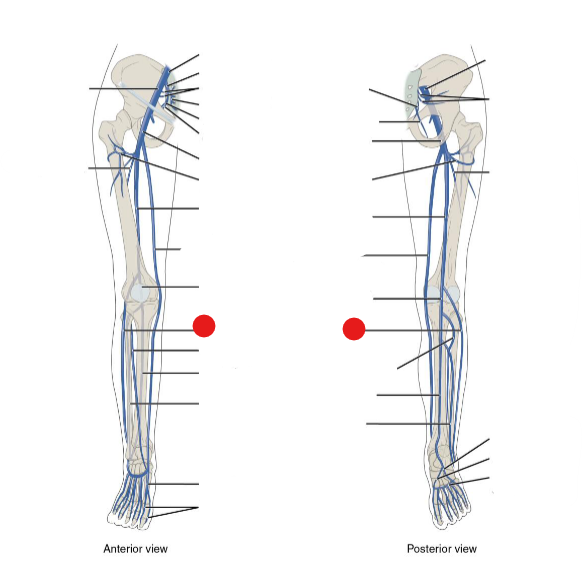 <p>Identify the structure pinned</p>