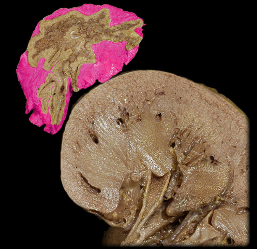 term image