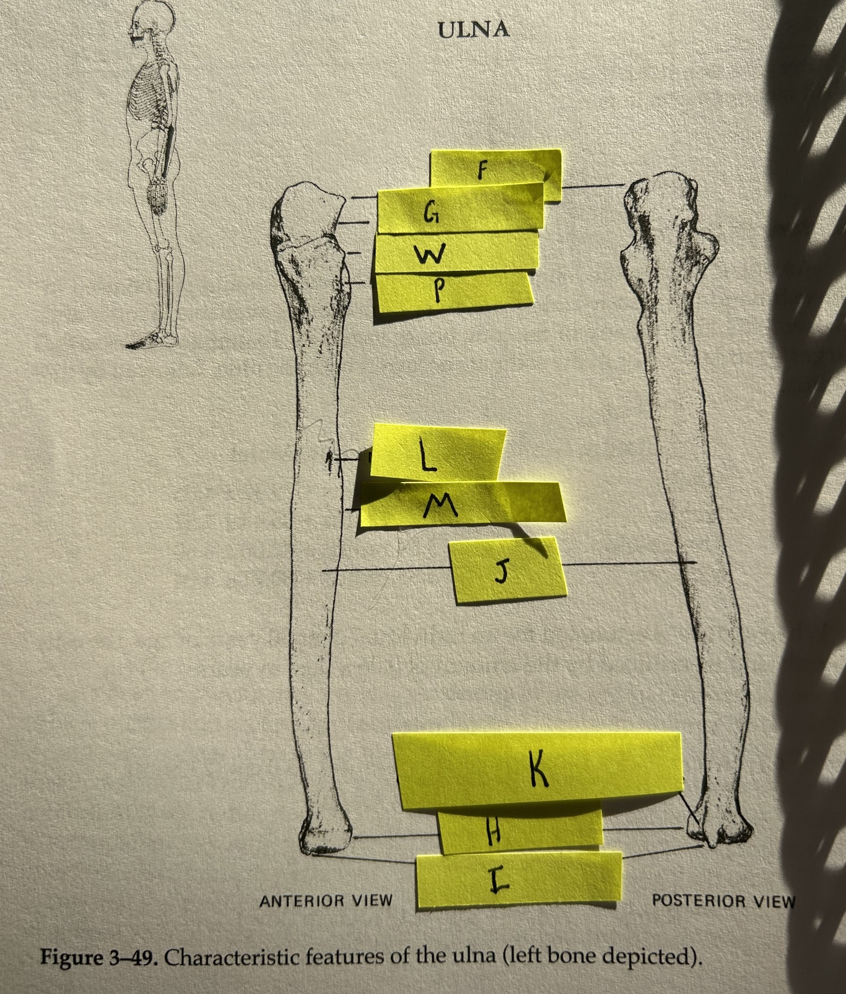 <p>Shaft (Ulna)</p>