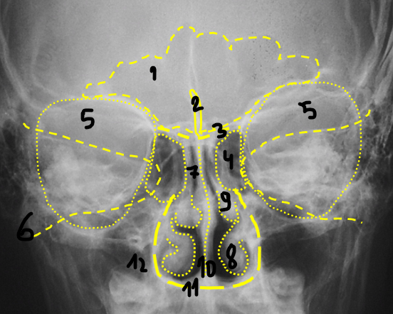 term image