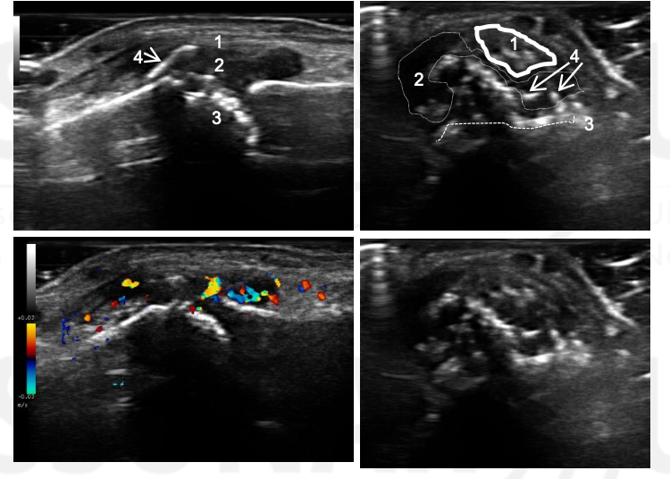 <p>Name 1-4.</p><p>What condition is this?</p>