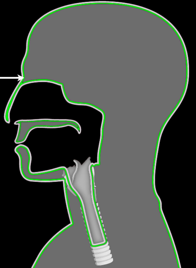 <p>Describe the tissue just deep of the surface for all these zones</p>