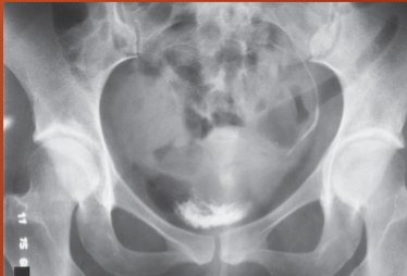 <p>what is this a projection of</p>