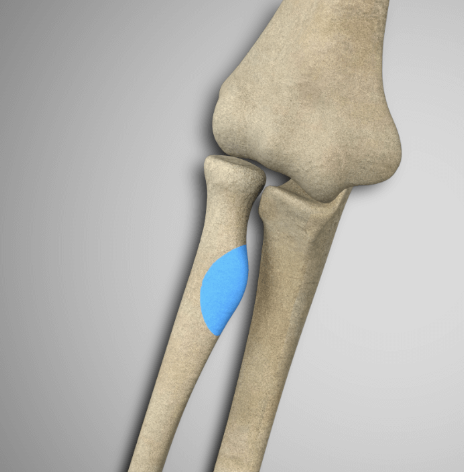 <p>Tuberosity</p>
