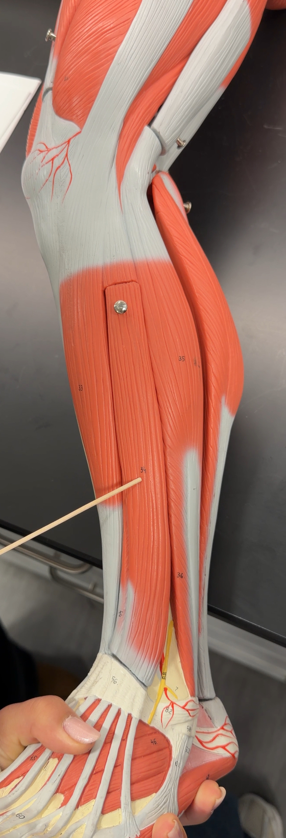 <p>name the muscle and its function</p>