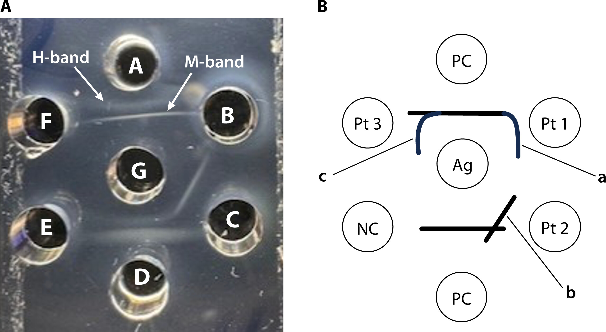 <p>Immunodiffusion/precipitation in gel matrix</p>