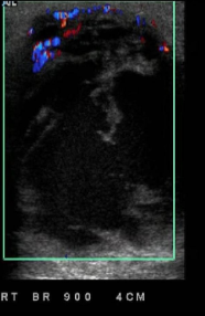 <p>Identify this image. </p>