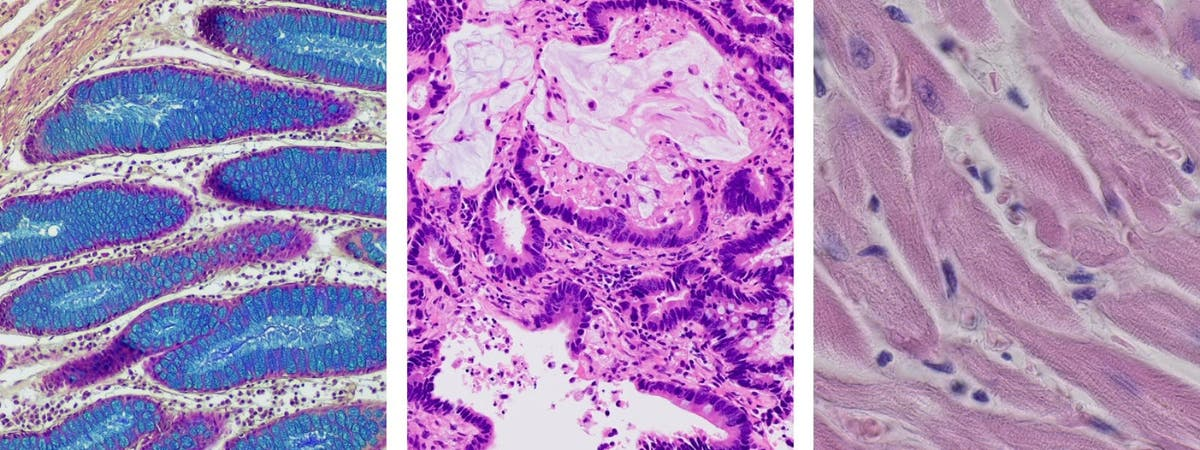 <p>brightfield microscopy</p>