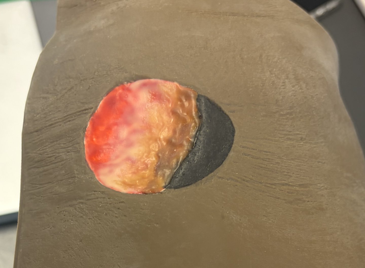 <p>what would you do to care for this wound?</p>