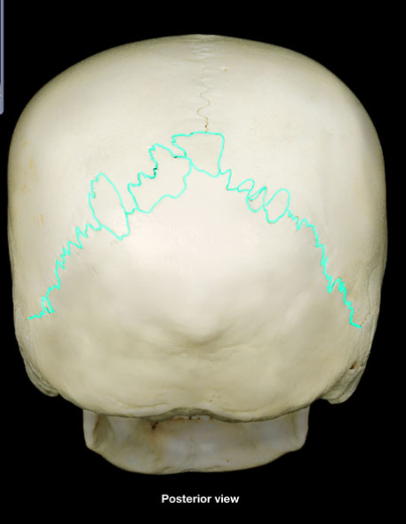 <p>What is the name of this structure?</p>