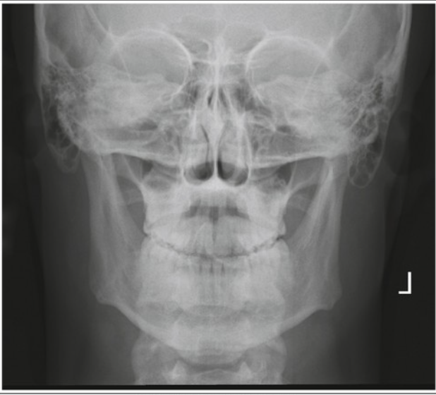 <p><span><span>The below image is a PA mandible, pick the suitable critique.</span></span></p>