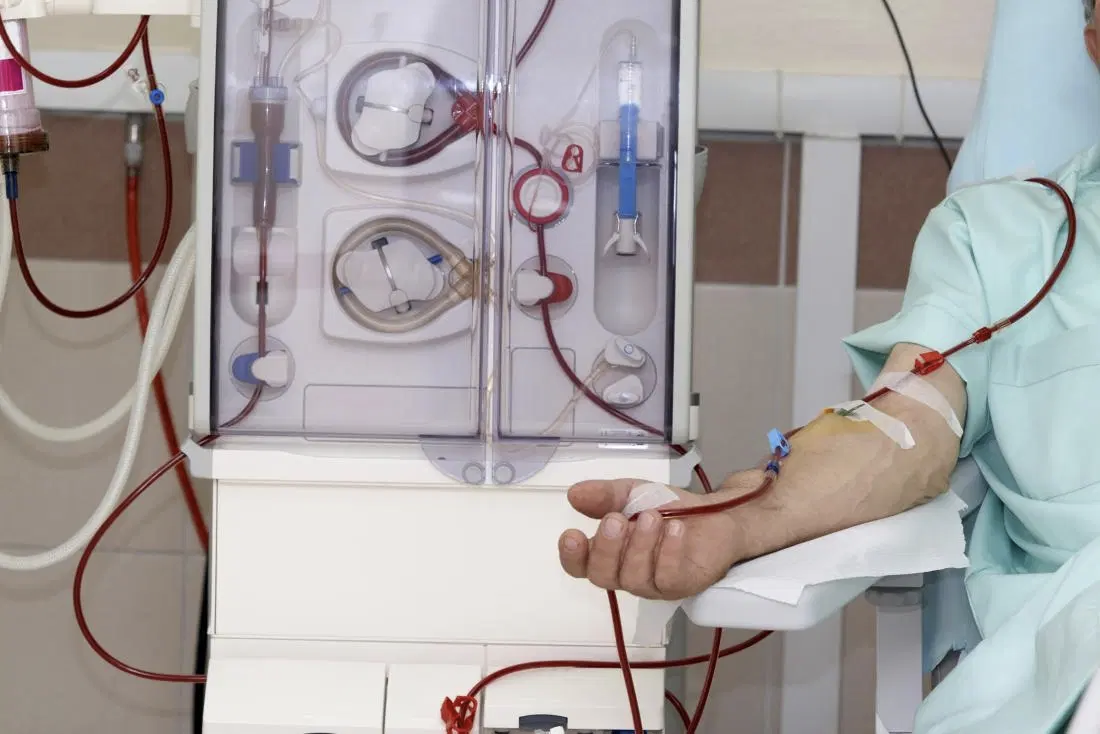 <p><strong>hemodialysis</strong></p><p>-blood pumped from _____</p><p>→ flows through ___ traveling through dialysis fluid</p><p>→ ________ into surrounding fluid</p><p>-nutrients, drugs can be administered via fluid</p><p>→ ex: erythropoietin, heparin</p><p>-blood returns via ____</p>
