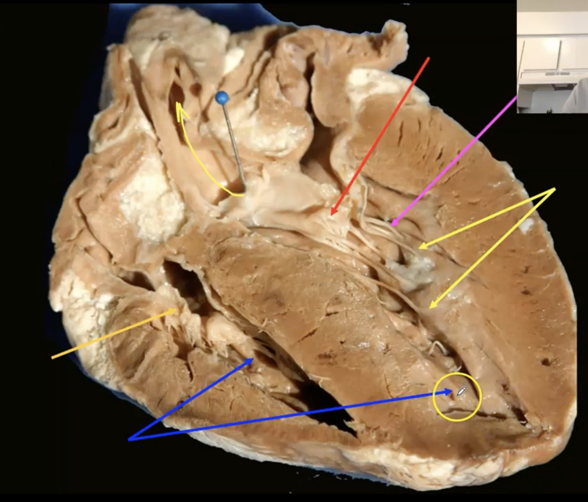 <p>What is the red arrow pointing to?</p>