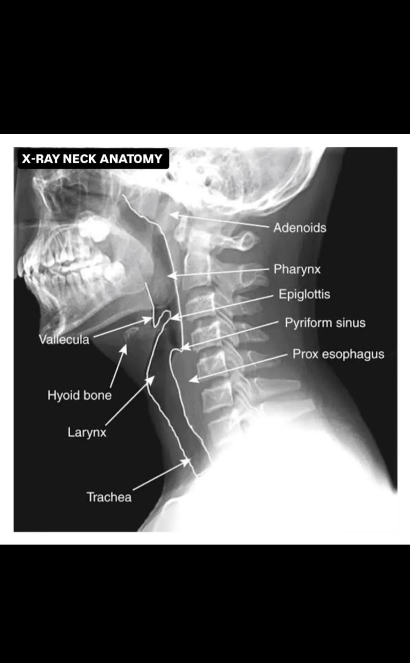<p>From Pharynx to midthoracic region</p>