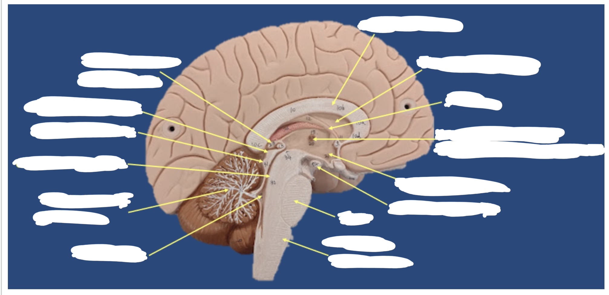 <p><a target="_blank" rel="noopener noreferrer nofollow" class="link" href="https://assets.knowt.com/user-attachments/99b59c49-a63c-4235-a924-366256e72cf8.jpg" data-prevent-progress="true">https://assets.knowt.com/user-attachments/99b59c49-a63c-4235-a924-366256e72cf8.jpg</a></p>