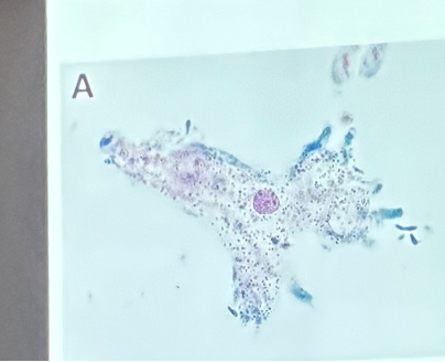 <p>What is this organism?</p>