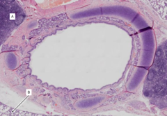 <p>Identify the tissue labeled B</p>