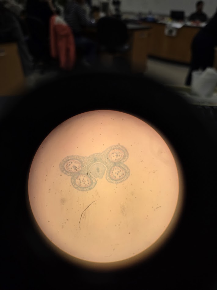 <ol><li><p>is this an angiosperm or a gymnosperm?</p></li><li><p>what structure is this?</p></li><li><p>what is the ploidy?</p></li></ol><p></p>