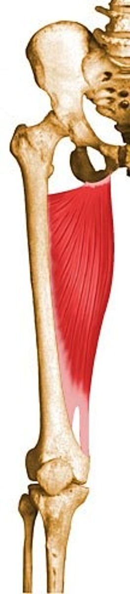 <p>adducts, flexes, and laterally rotates thigh</p>