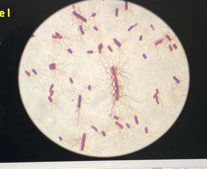<ul><li><p><span><strong>Cell Shape:</strong> Straight, Gram-negative bacilli ranging from 0.4 to 0.8 μm in diameter and 1.0 to 3.0 μm in length.</span></p></li><li><p><span><strong>Motility:</strong> Highly motile via numerous peritrichous flagella, which give it a unique ability to undergo morphological phase variation. It can alter between a standard "swimmer" cell and an elongated, hyper-flagellated "swarmer" cell.</span></p></li></ul><p></p>