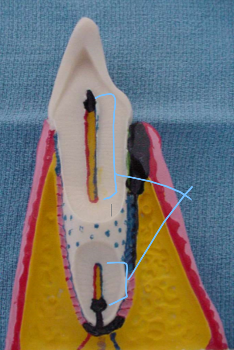 <p>The structure shown in the __ __</p>