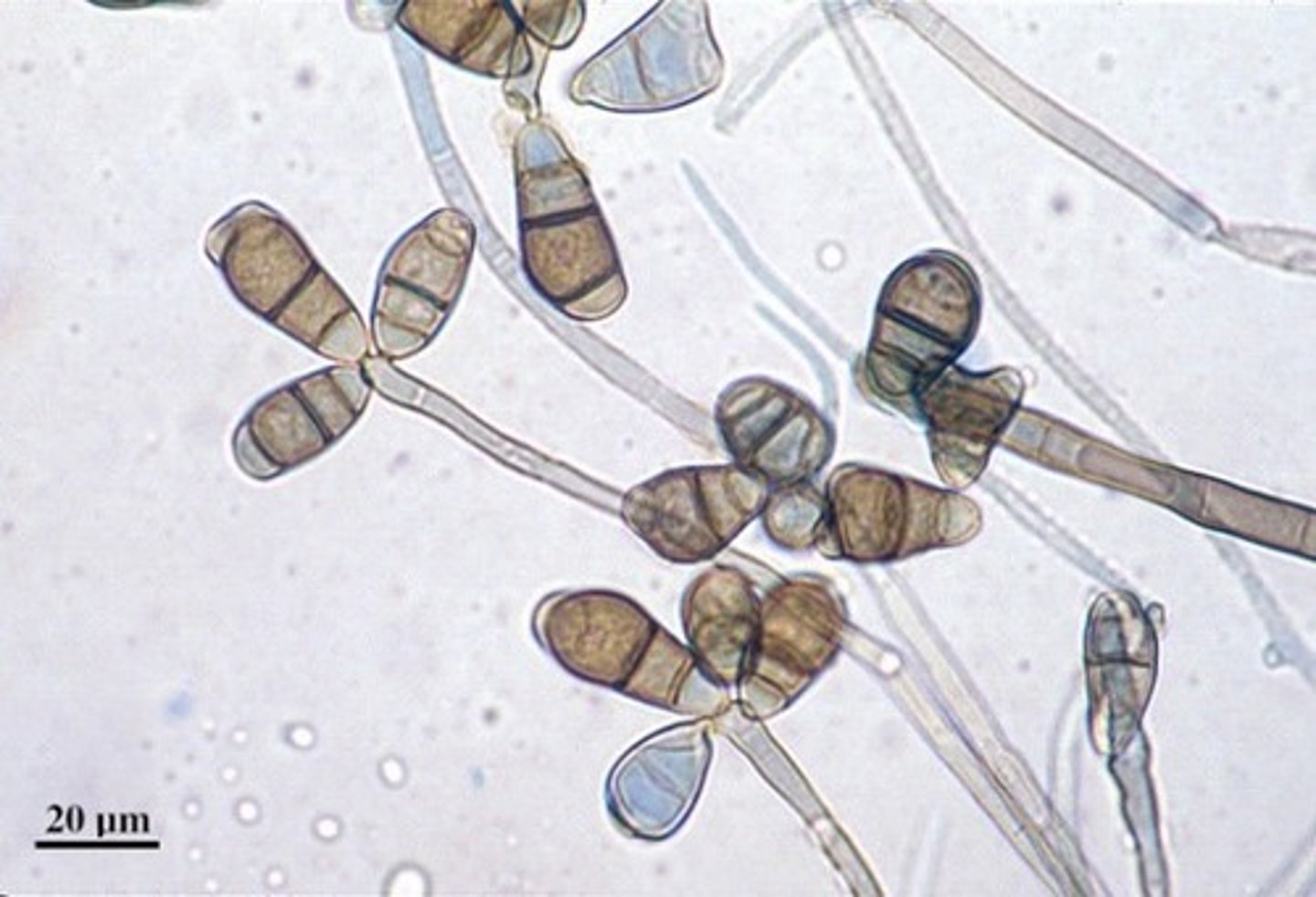 <p>Branched twisted conidiophores</p>