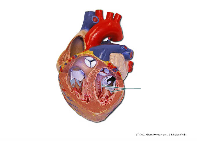 <p>Identify the highlighted vessel.</p>