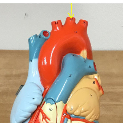 <p>name this artery </p>