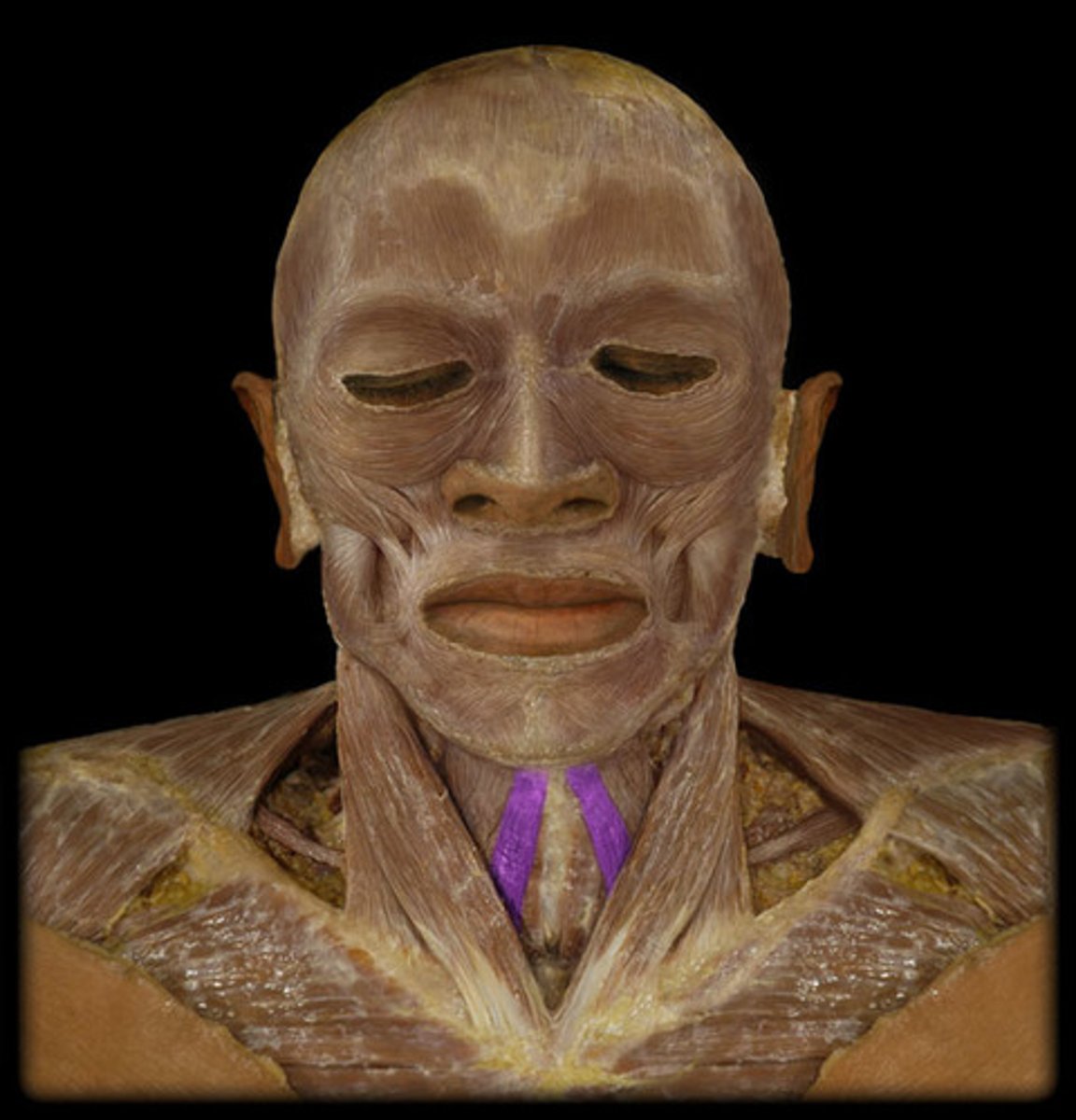 <p>Region:</p><p>Neck</p><p>Action:</p><p>Depresses hyoid</p><p>Innervation:</p><p>Cervical plexus (C1-C3)</p>