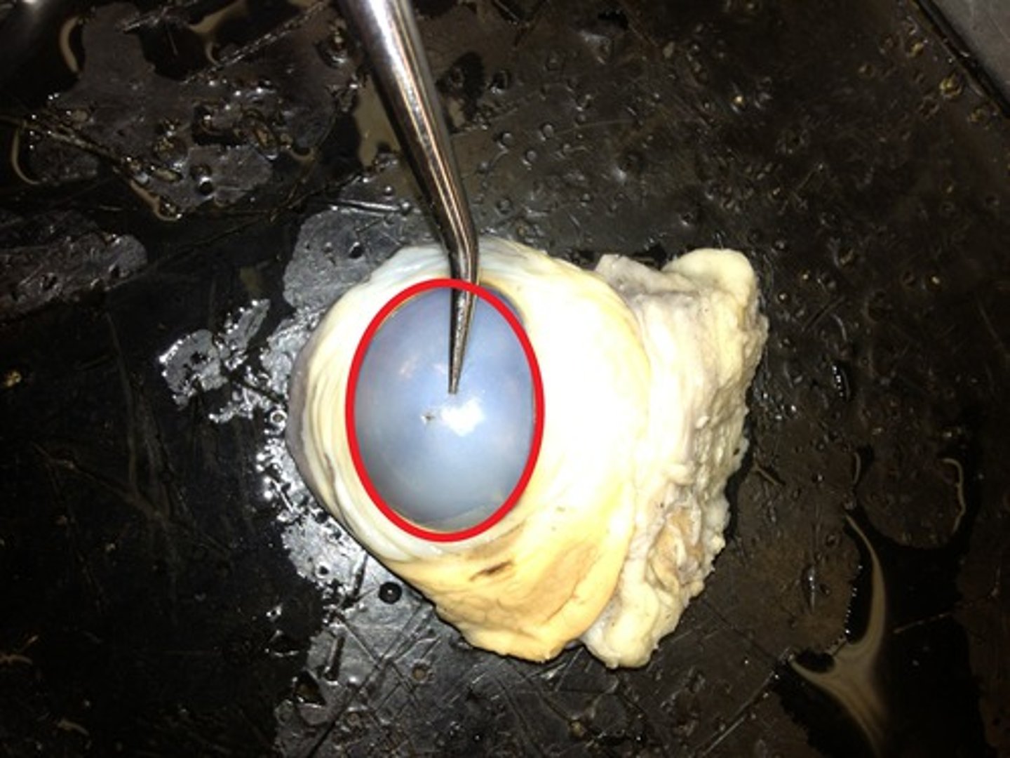 <p>The transparent layer forming the front of the eye. It functions like a window that controls and focuses the entry of light into the eye.</p>