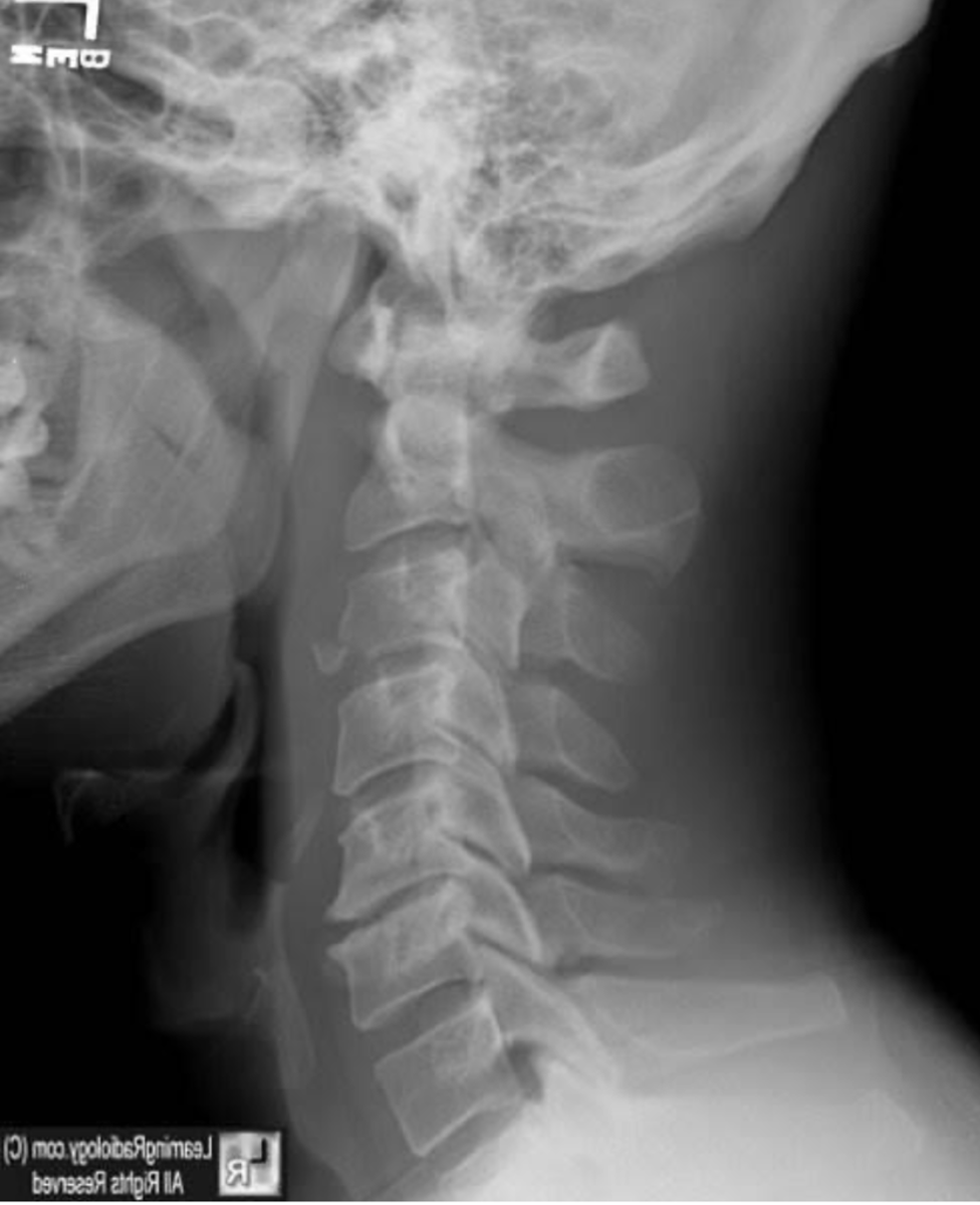 <p>What is the diagnosis?</p>