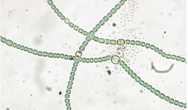 <p>What is this?<br><br>A) Spirogyra<br>B) Volvox<br>C) Euglena<br>D) Anabaena</p>