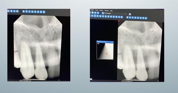 <p>-play with the box to see what would be changed</p><p>-move the mouse L and R to adjust brightness</p><p>-move mouse up and down to adjust contrast</p>