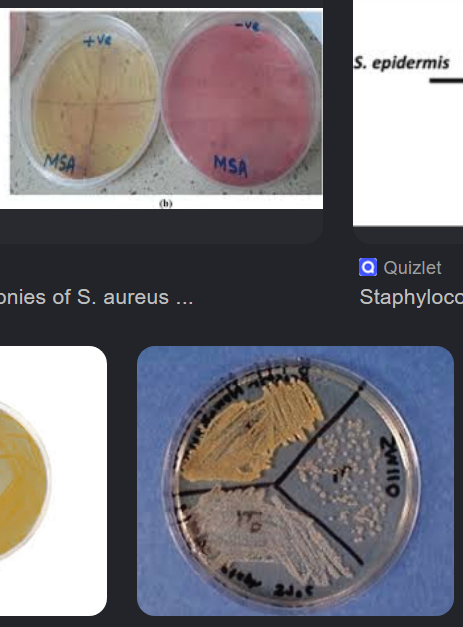 <p>MSA: selective due to high salt concentration; differential because s. aureus ferments mannitol making it yellow</p><p>SM110: selective due to high salt concentration; differential because s. aureus shows up golden due to a pigment <span>staphyloxanthin</span></p>