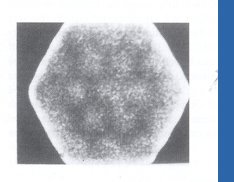 <p>Image A is an example of ____, and is caused by the photopeak being set ____</p>