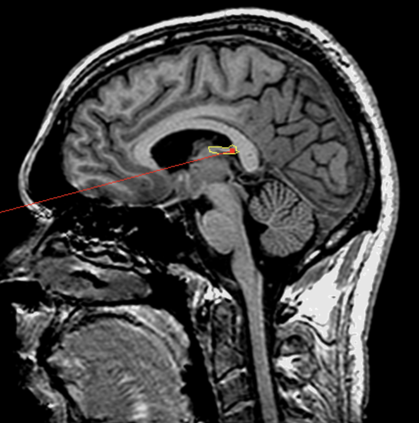 <p>What is the area highlighted called?</p>