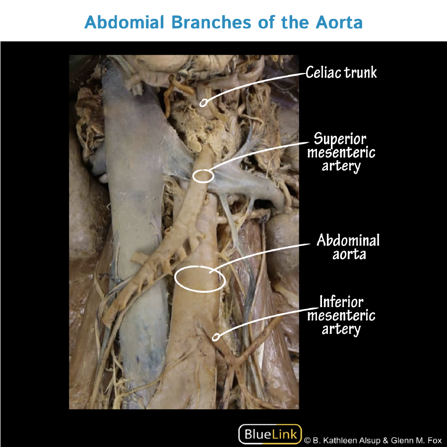 <p>1st branch of the abdominal aorta</p><p>leaves abdominal aorta just below T-12 vertebrae</p><ul><li><p>structure</p></li></ul><p></p>