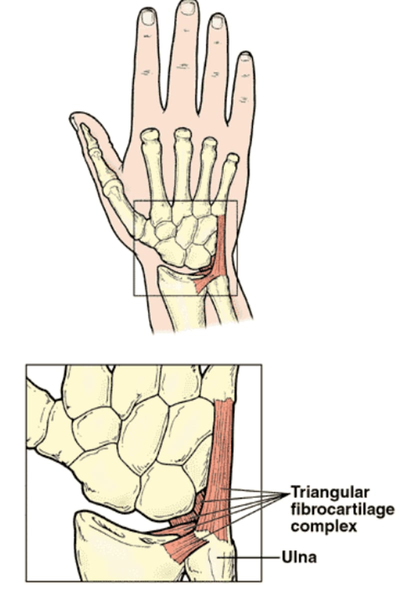 <p>Complex structure comprised of radioulnar disc &amp; fibrotic attachments that provide primary support for the distal radioulnar joint</p><p>-located on the medial aspect of the wrist</p><p>---cushion between the ulna &amp; carpal bones</p><p>-disruption can impact the ulna/ulnar side</p><p>-functionally considered an extension of the radioulnar joint &amp; the distal radius (articular surface)</p>