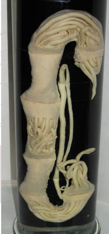 <p><strong>Toxocara vitullorum</strong> - roundworm, in cattle</p><ul><li><p>M, Spherical, 3 thick shells (rough surface), unembryonated (1 cell), dark brown</p></li><li><p>location: SI (calf)</p></li></ul><img src="https://assets.knowt.com/user-attachments/5e96254c-18de-4caa-b765-ccaba3b1a5c8.png" data-width="50%" data-align="center" alt="knowt flashcard image"><p>Nematoda</p>