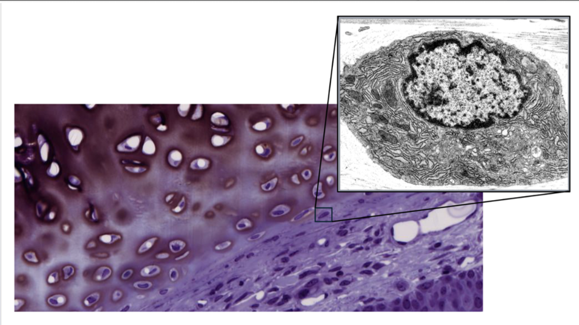 <p>Fibroblasts</p>