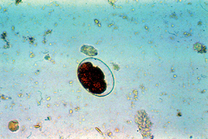 <p>egg has very thin shell and mass of cells in center</p><p></p>