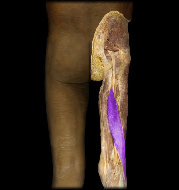 <p>What is this muscle called?</p>