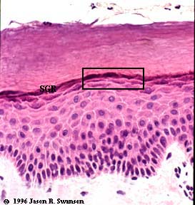 <p>Appears as a dark line on the slide, had keratinocytes that make keratin. </p>