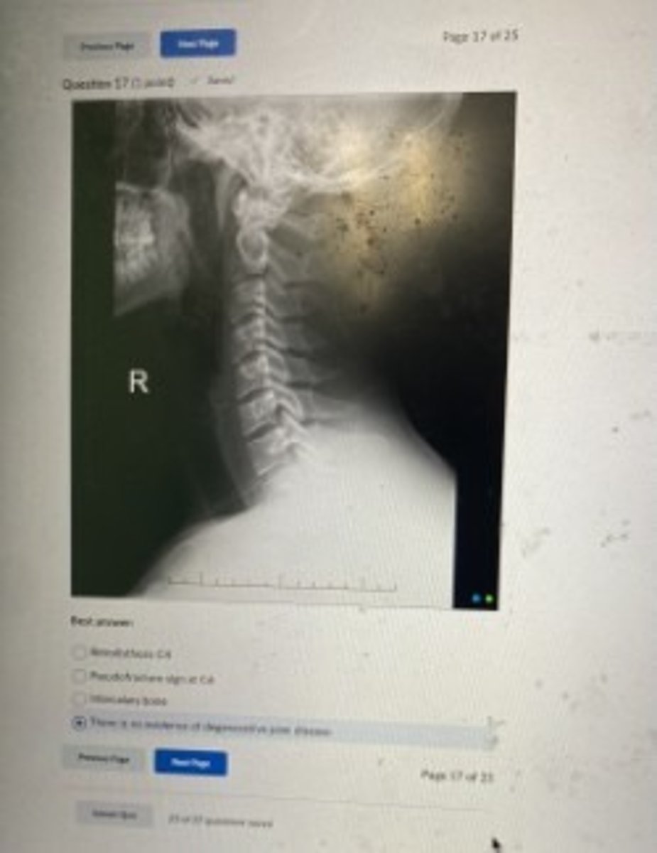 <p>There is no evidence of degenerative joint disease</p>