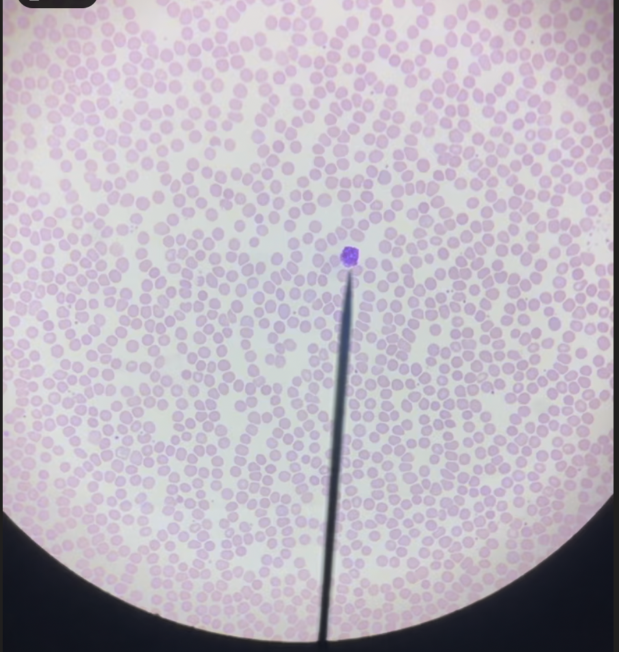 <p>What Blood Cell is on this microscope slide</p>